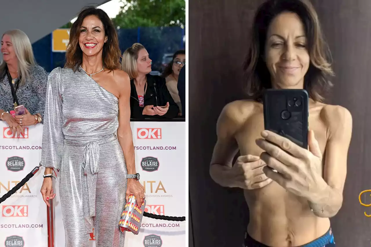 My breast reconstruction after my mastectomy looked like a 'plasticine boob', says Countryfile's Julia Bradbury