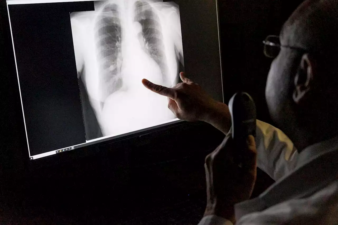 Using AI to help San Antonio radiologists reduce X-ray reading errors