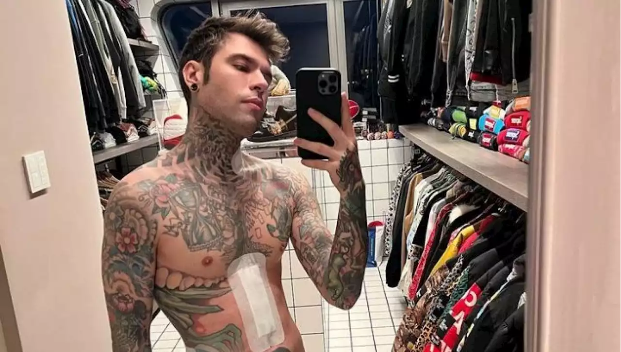 Fedez, nuovo selfie e rivelazione: 'Ho perso quasi 10 chili dall'operazione'