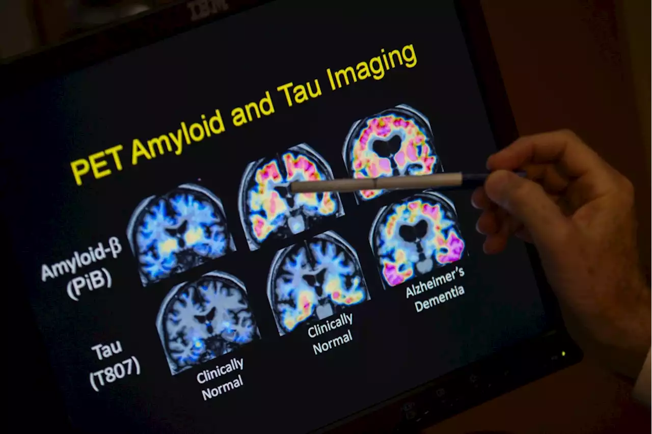 Aurora site part of effort to diversify Alzheimer’s drug trials — but there’s a long way to go