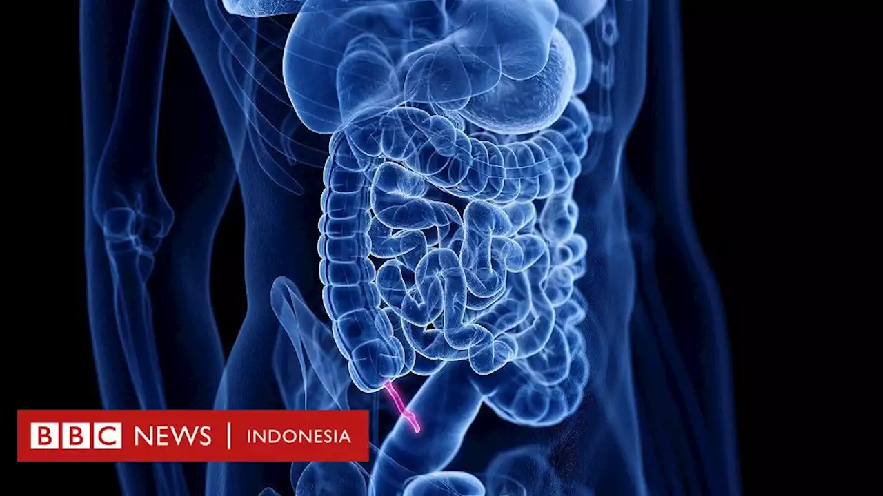 Kerap dianggap organ 'sisa', usus buntu ternyata berharga - BBC News Indonesia