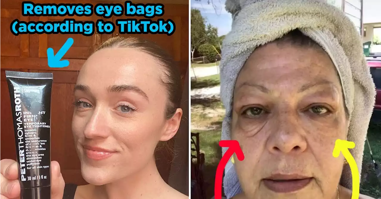 This 'Eye Tightener' That Supposedly Erases Under-Eye Bags Went Viral On TikTok, So I Tried It