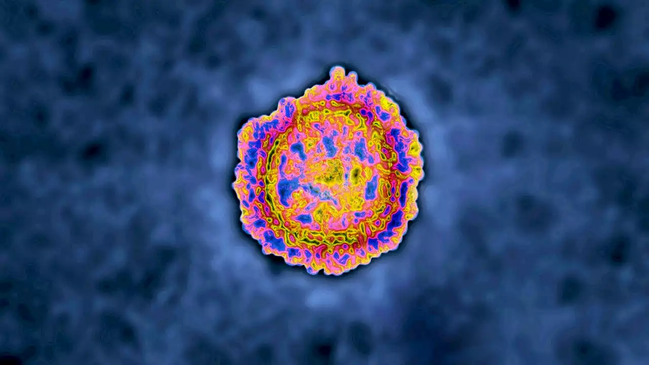 COVID-19 re-infection can happen sooner than you think, CDC study says