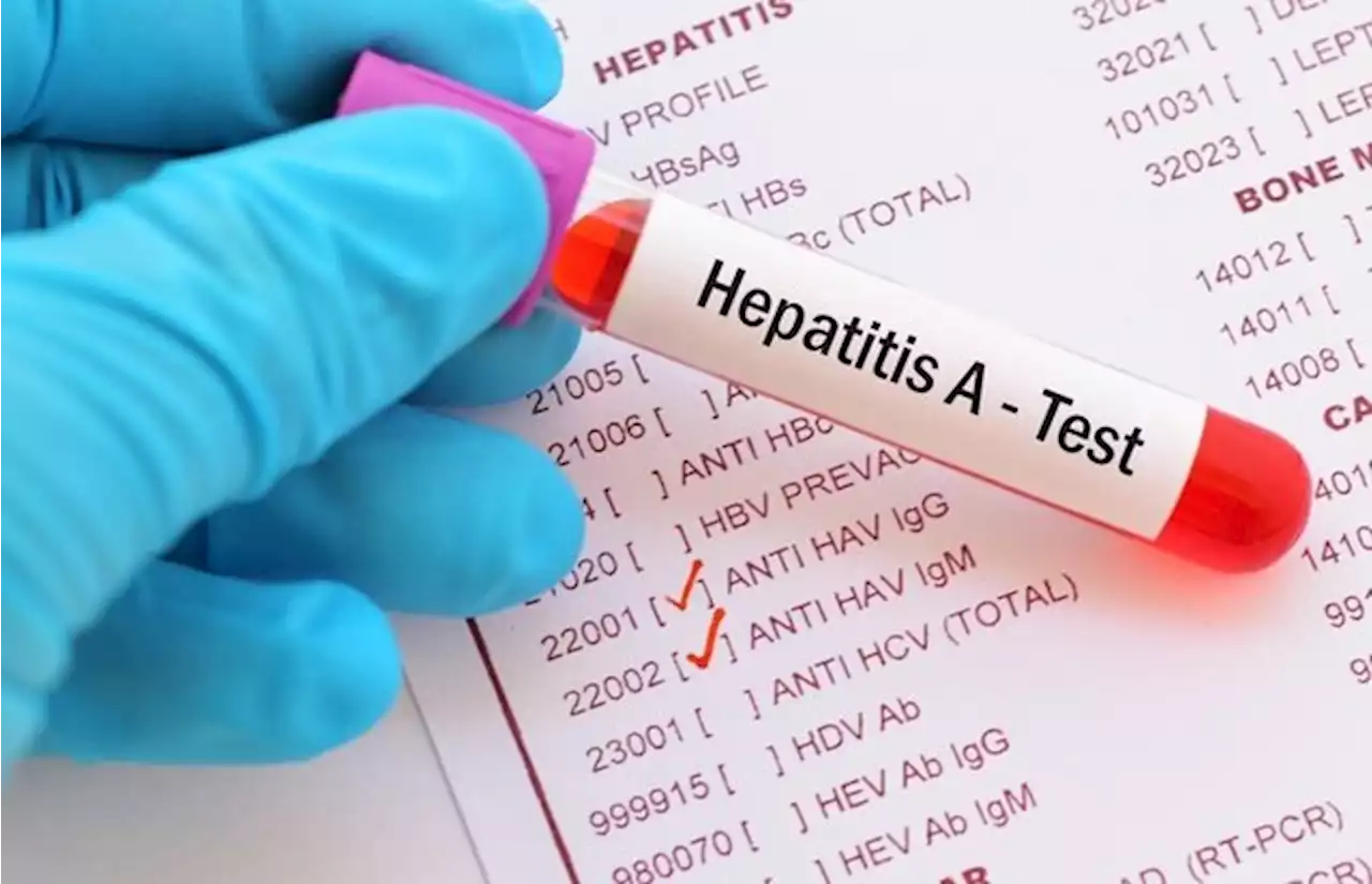 Children in more countries suffer mystery hepatitis | News24