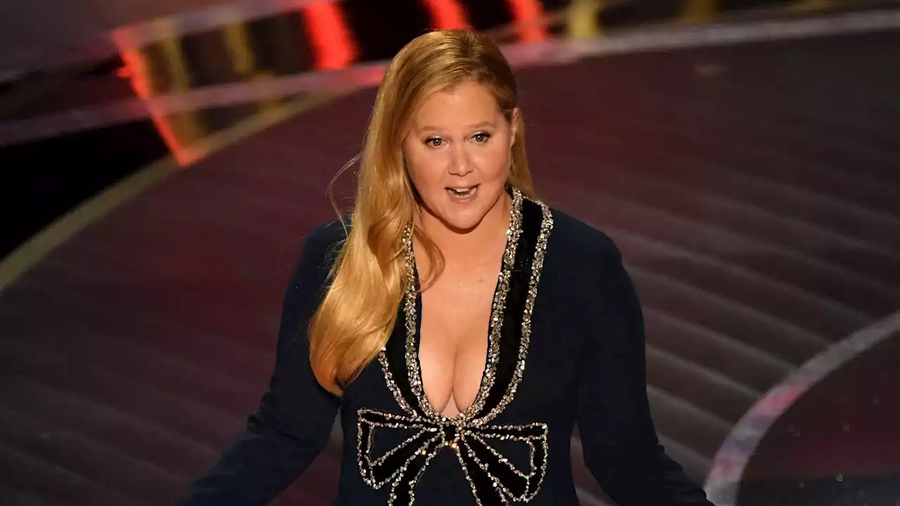 Amy Schumer revealed her trichotillomania to 'alleviate her shame'