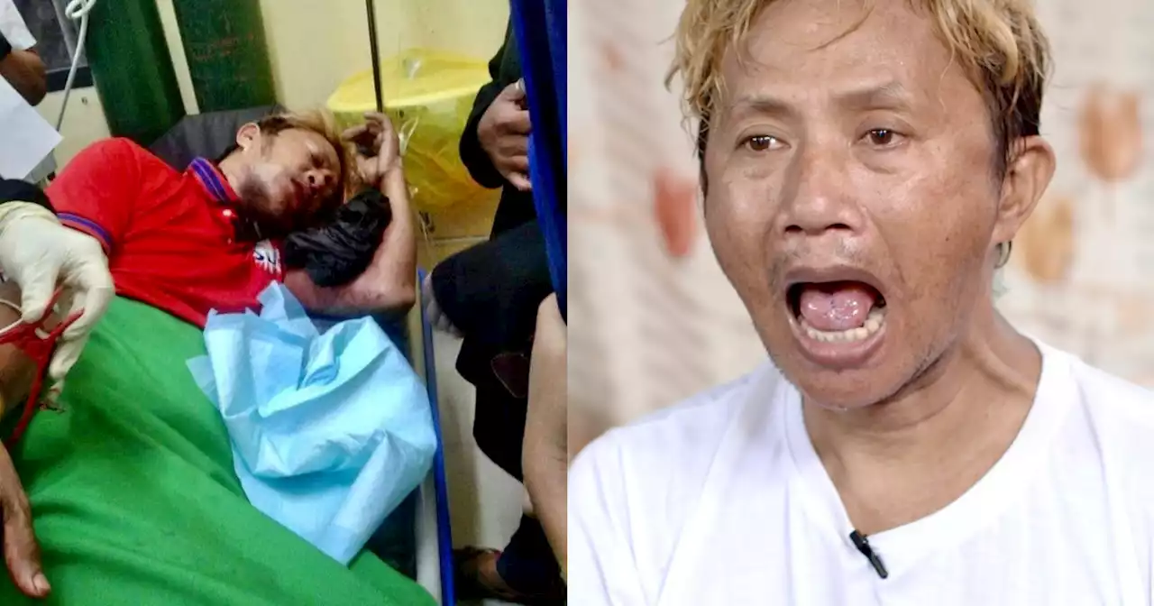 Taxi driver in Cebu loses nearly half of his tongue after encounter with hold-uppers