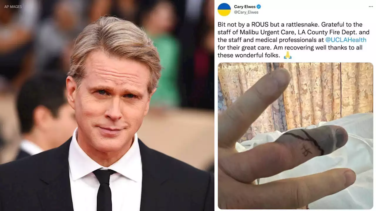 'The Princess Bride' actor Cary Elwes recovering after rattlesnake bite in Malibu