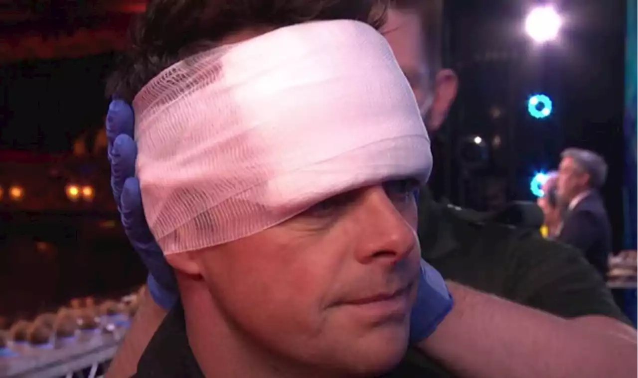 Ant McPartlin bandaged up by medics after suffering BGT injury