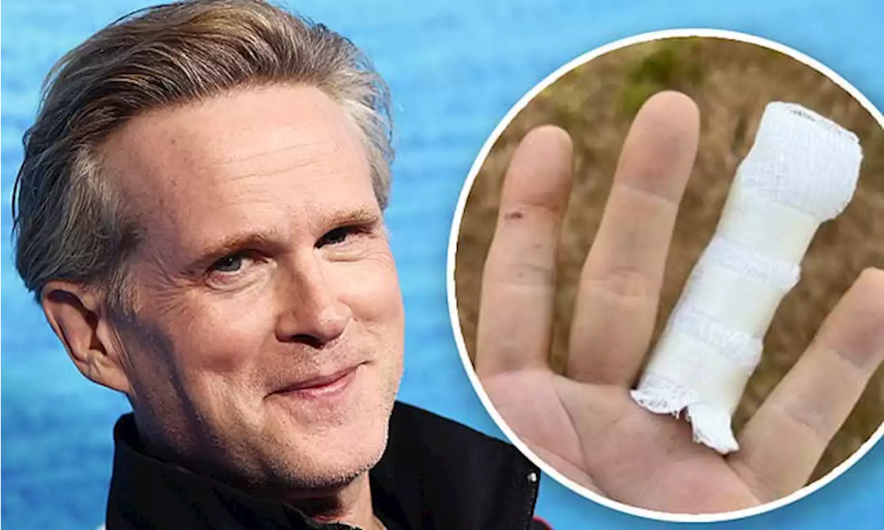 Cary Elwes, 59, shares image of bandaged finger after rattlesnake bite