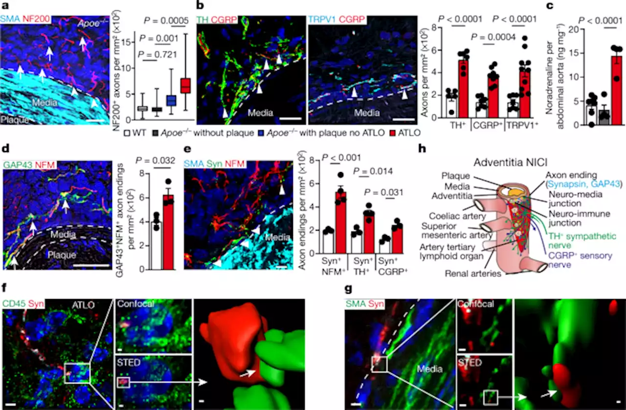 Neuroimmune cardiovascular interfaces control atherosclerosis - Nature