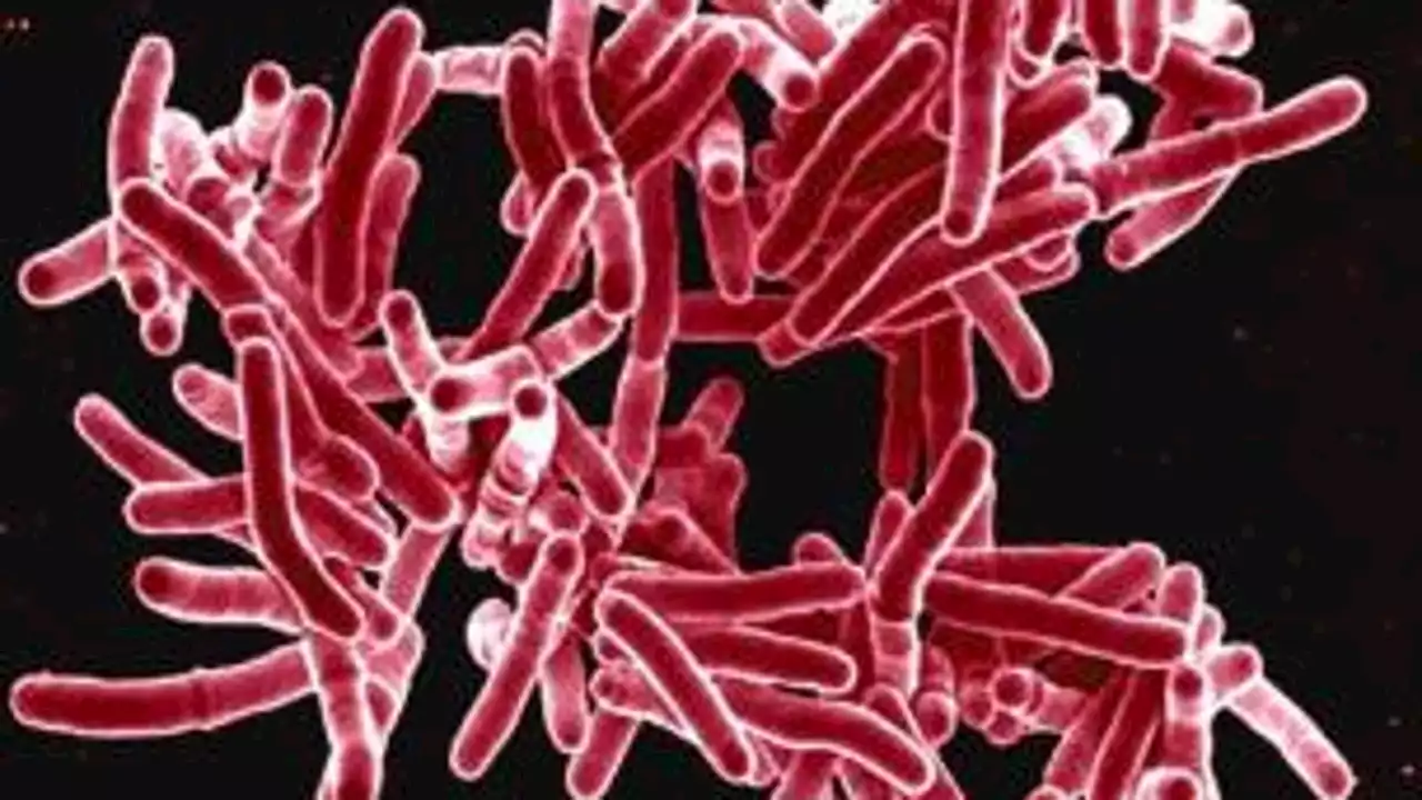 DOH: Tuberculosis cases rising in Washington state