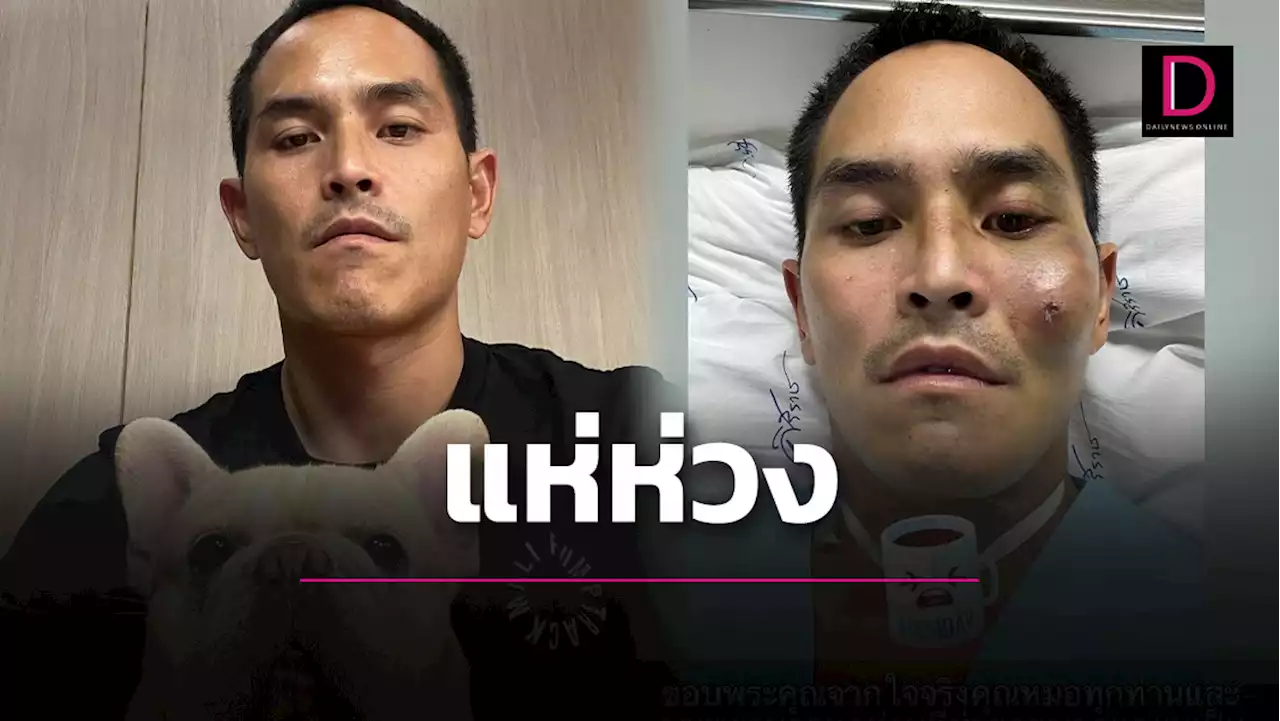 แฟนๆแห่ห่วง 'สงกรานต์'อยู่ ICU ถึง 7 วันหลังบาดเจ็บหน้าเปลี่ยน | เดลินิวส์