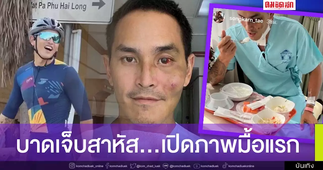 บาดเจ็บสาหัส 'สงกรานต์ เตชะณรงค์' เปิดภาพมื้อแรก หลังอยู่ใน ICU มา 7 วัน