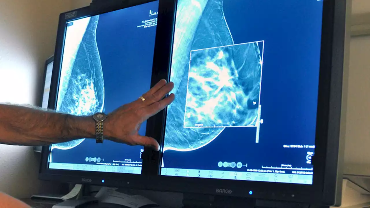 Key target for waiting times on cancer treatment missed in 98% of NHS England areas in January