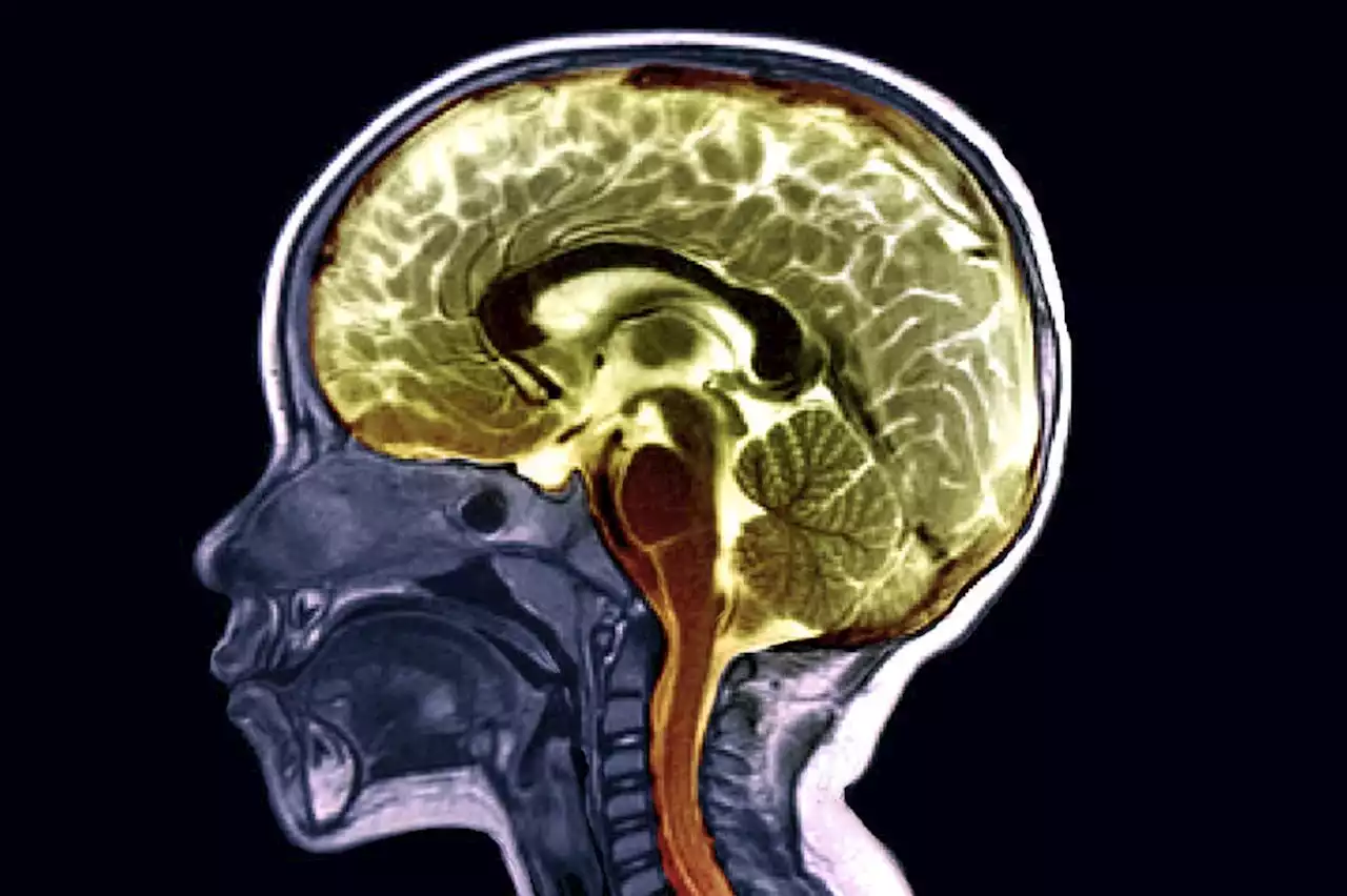 Map of how our brain changes with age could help diagnose diseases