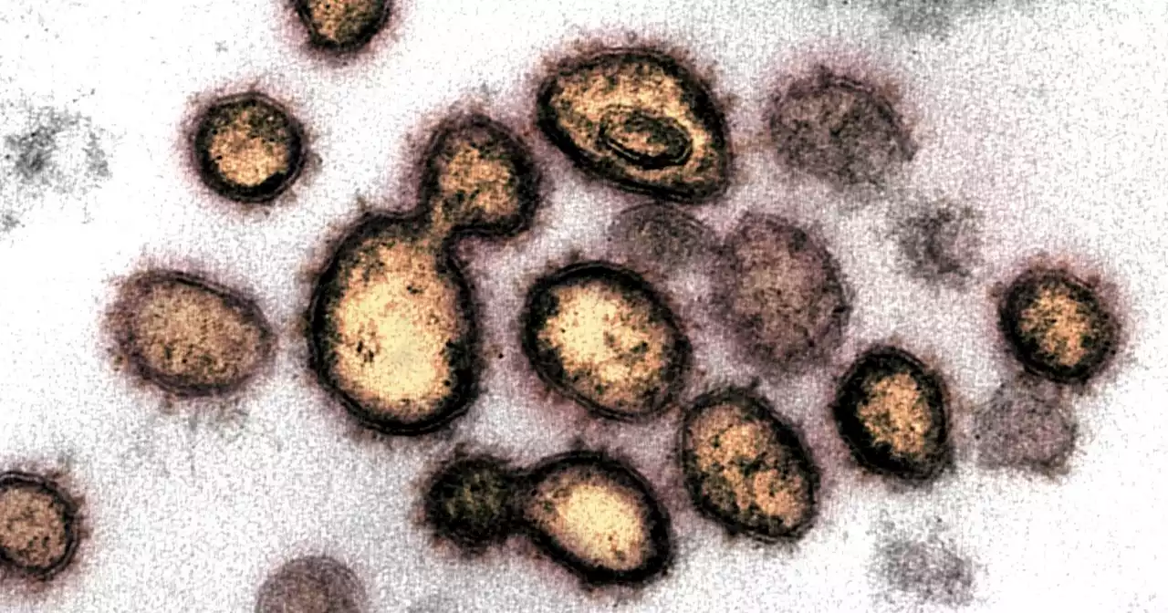 Covid recombinante: cómo son XD, XE, XF y XS, las nuevas versiones del coronavirus que podrían llegar a la Argentina