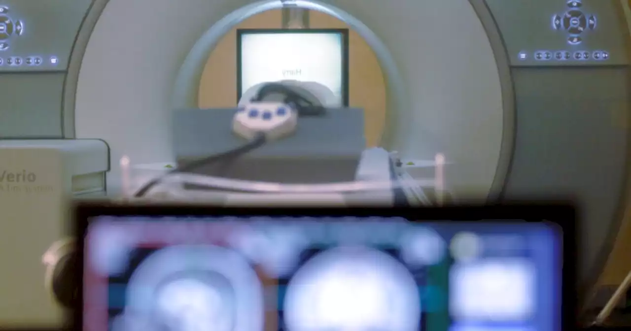 Scans reveal the brain's early growth, late decline and surprising variability