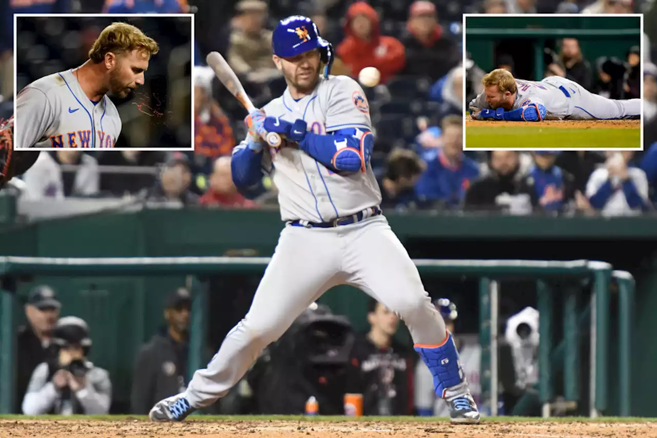 Mets’ Pete Alonso drilled in face, exits win over Nationals