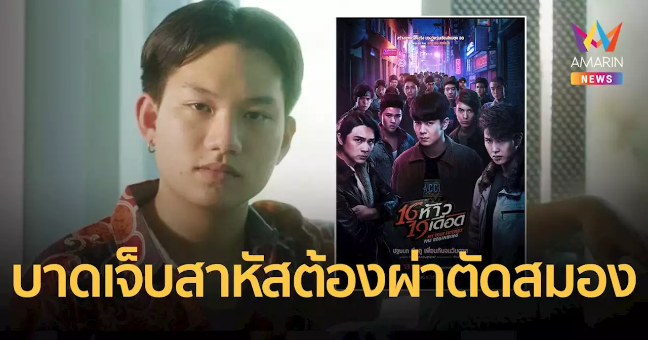 นักแสดงจาก ภ. “16 ห้าว 19 เดือด” ถูกคนเมาขับรถพุ่งชนมอเตอร์ไซค์ บาดเจ็บสาหัสต้องผ่าตัดสมอง