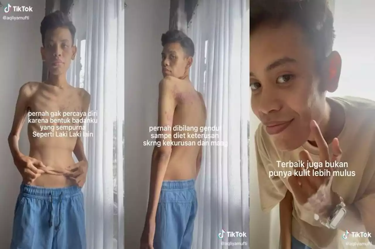 Kisah Mufti Aqliya yang Dibully Gendut hingga Nekat Diet Ketat, Kini Punya Tubuh Terlalu Kurus