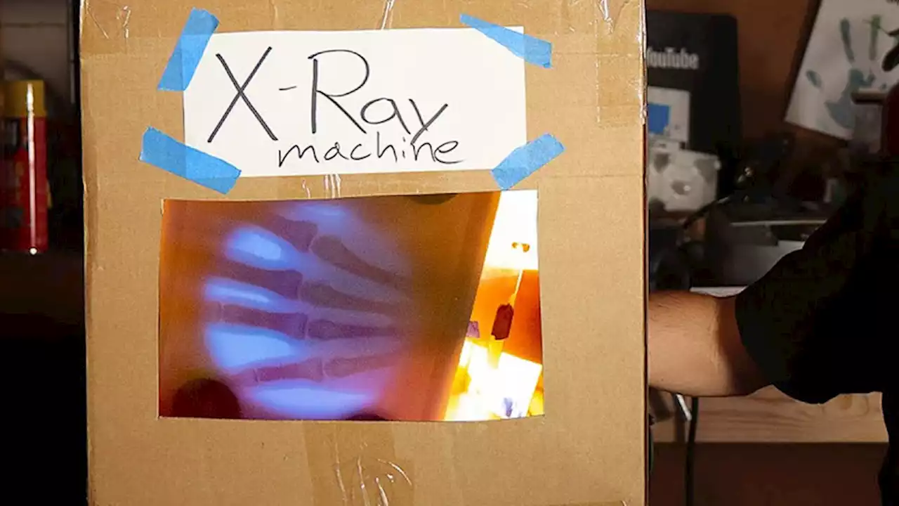 Engineer Builds His Own X-Ray After Hospital Charges Him $69K