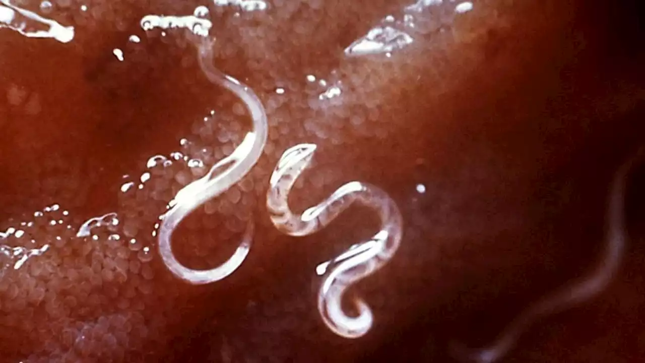 Parasitic worms get sucked into gender bias row amid claims of names being sexist