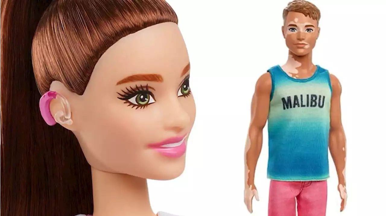 Mattel debuts Barbie with hearing aids, Ken with vitiligo