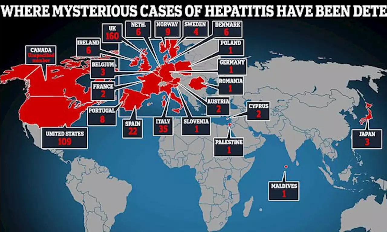 At least 12 children have now died from mystery hepatitis