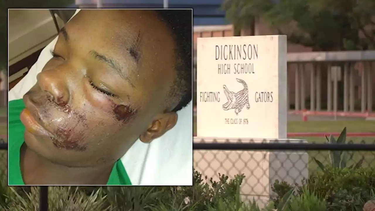 Student who has special needs was bruised and battered during high school arrest