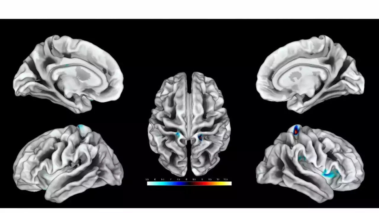 ¿El cerebro humano cada vez es más pequeño?