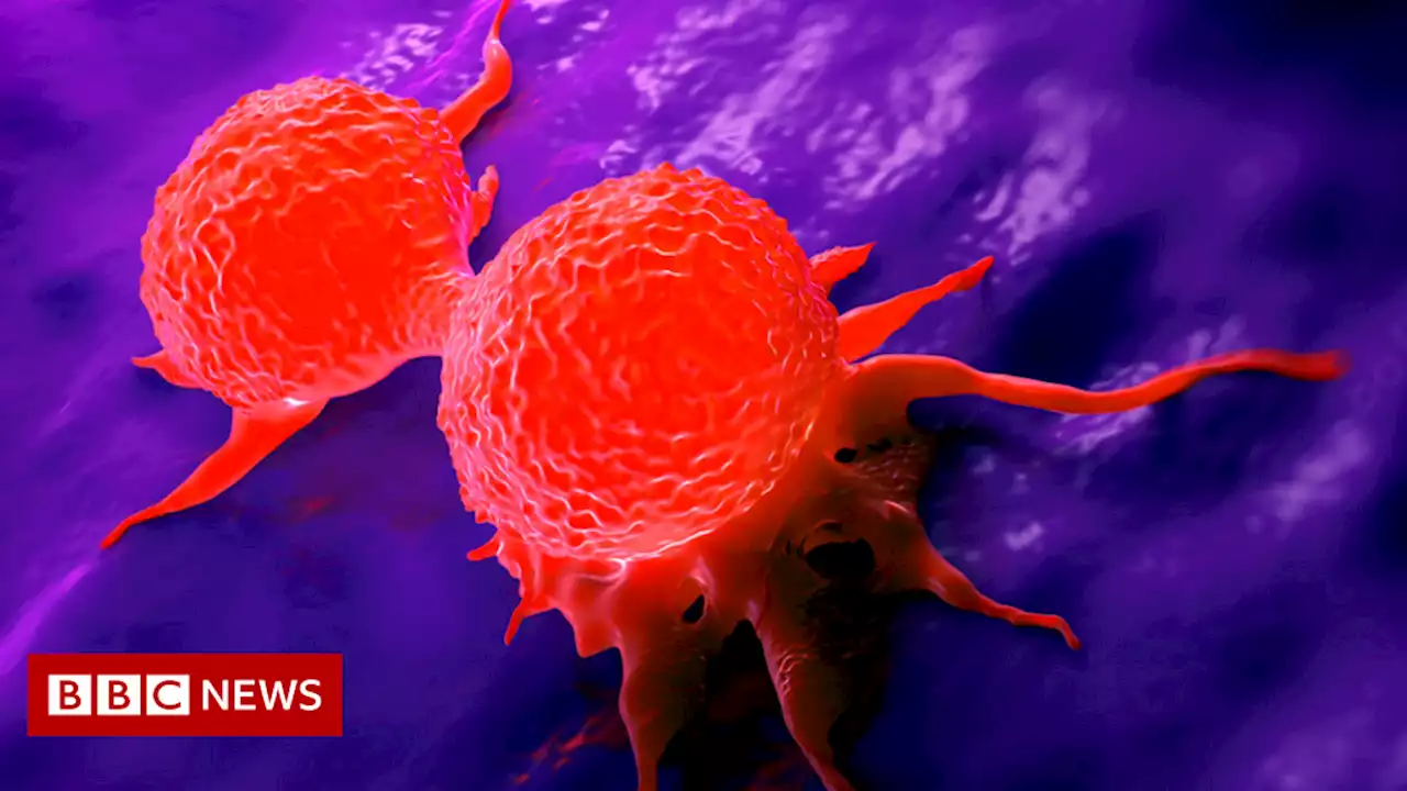 Breast cancer 'metal detector' recommended to NHS