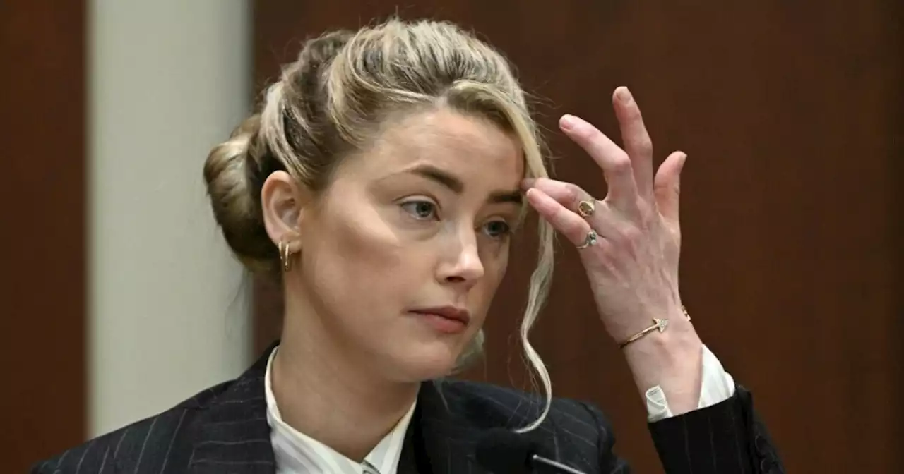 Amber Heard expone fotos de lesiones tras acusar de violencia a Johnny Depp