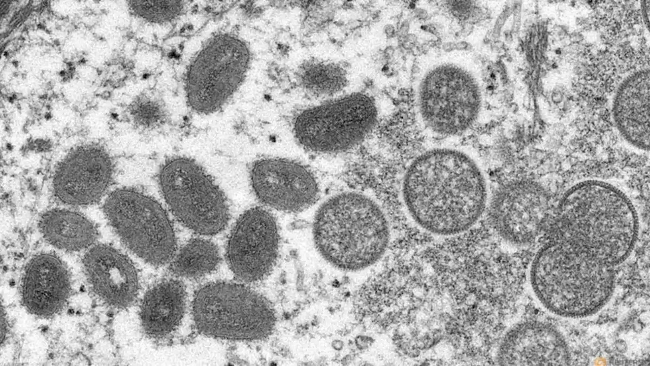 Siga gets requests for smallpox drug in Europe as monkeypox spreads