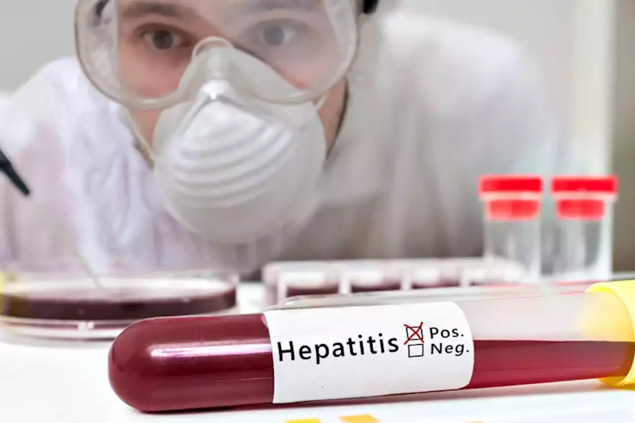 Hepatitis aguda infantil: qué se sabe de la infección de origen desconocido en América Latina