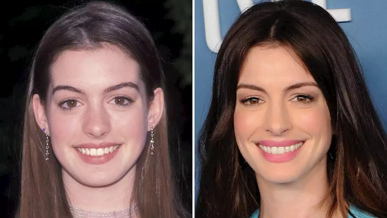 Anne Hathaway -- Good Genes Or Good Docs?!