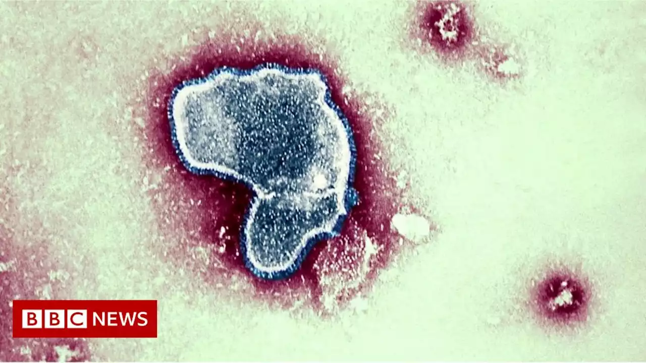 Cold virus killed 100,000 children globally in 2019