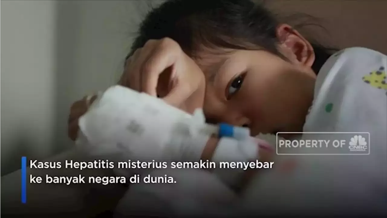 Waspada Ini 3 Tahap Gejala Hepatitis Akut Yang Serang Anak Indonesia Head Topics