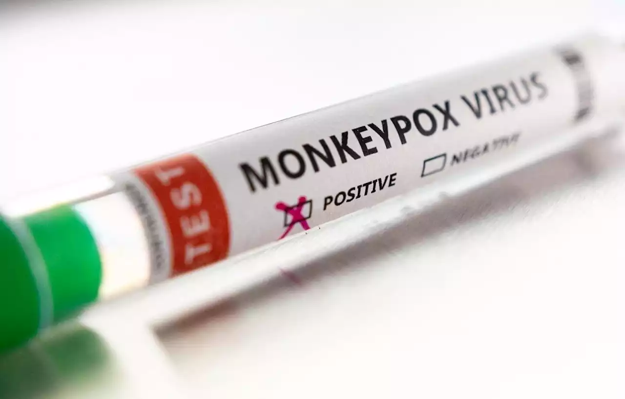 UK confirms local transmission of monkeypox