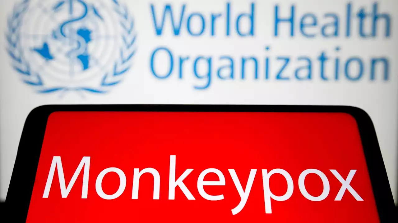 Florida Reports First Case Of Monkeypox, Third Potential Case In The U.S.