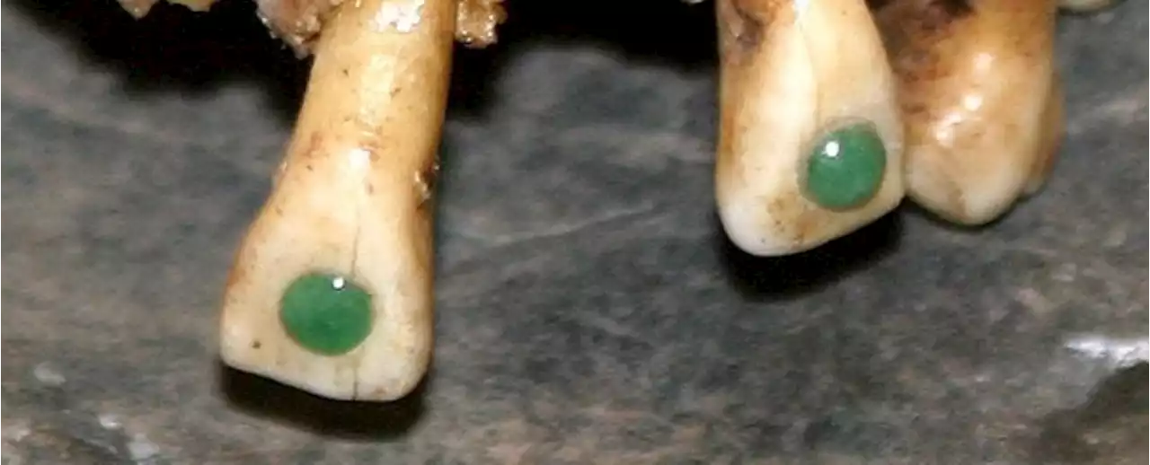 Ancient Maya Practice of Gluing Gemstones Onto Teeth May Have Been For More Than Bling