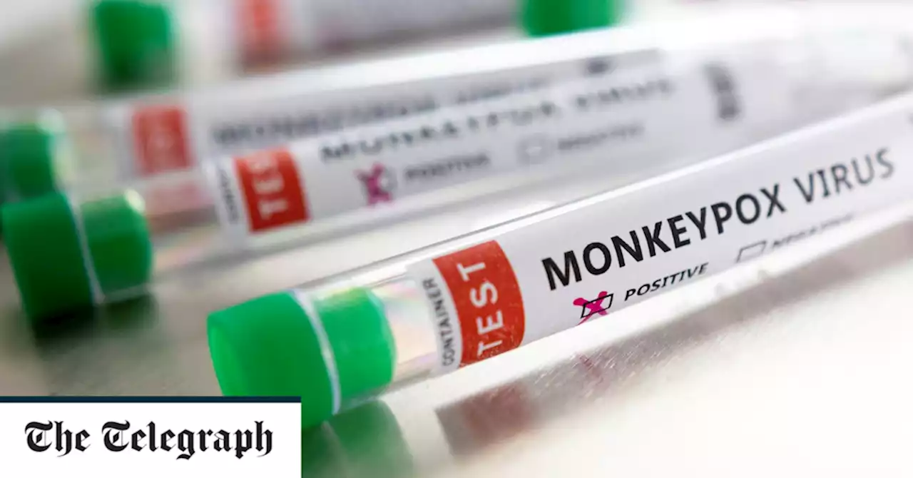 Monkeypox outbreak: First case detected in Scotland