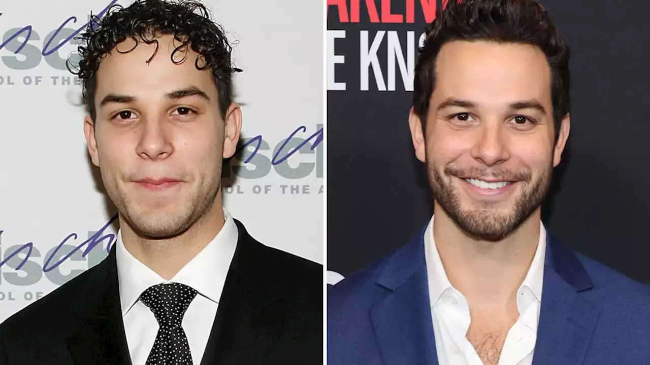 Skylar Astin -- Good Genes Or Good Docs?!