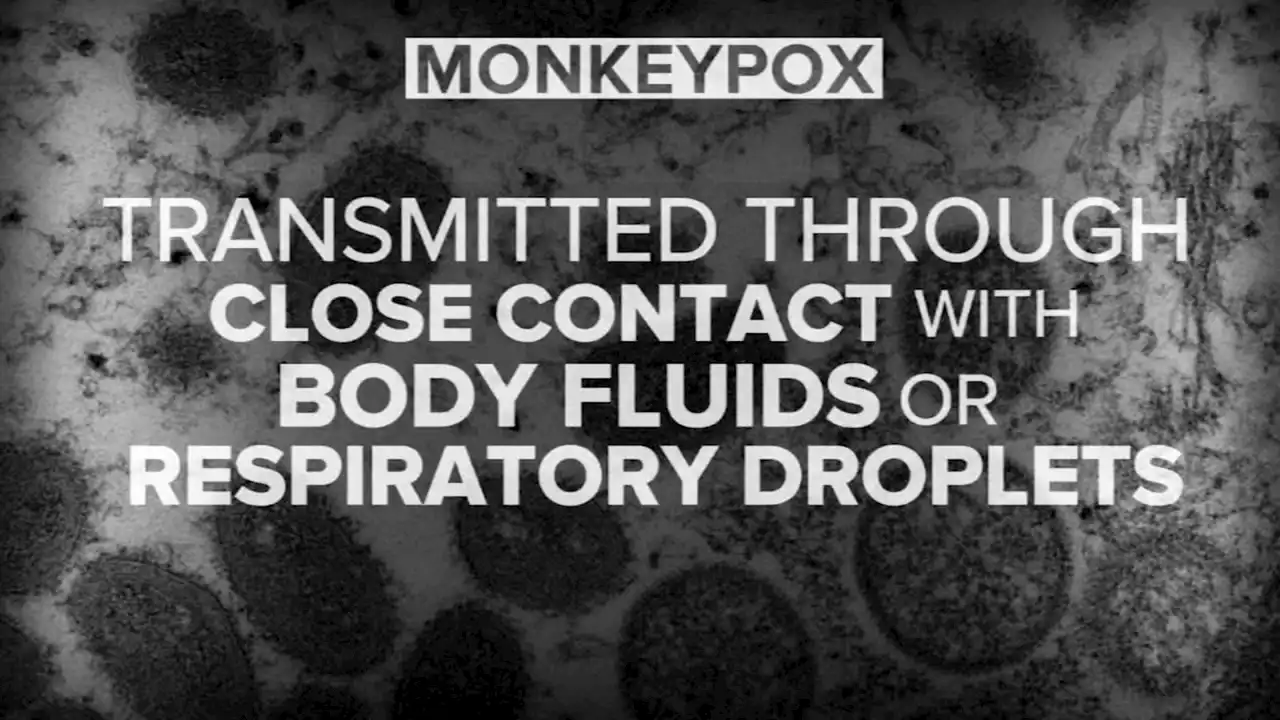 US in process of releasing monkeypox vaccine from national stockpile for 'high-risk' people: CDC