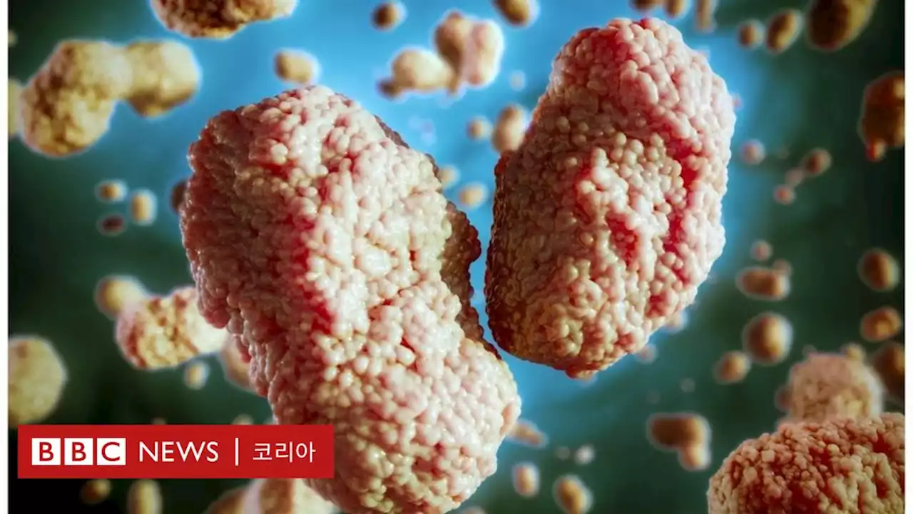 WHO, '원숭이두창 바이러스 확산 억제 가능' - BBC News 코리아