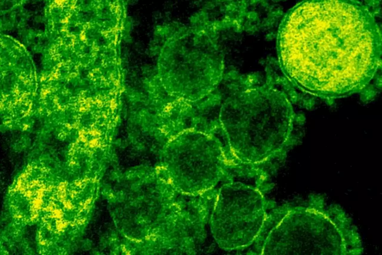 Virus Cacar Monyet Bisa Bermutasi? Simak Penjelasan WHO - Pikiran-Rakyat.com