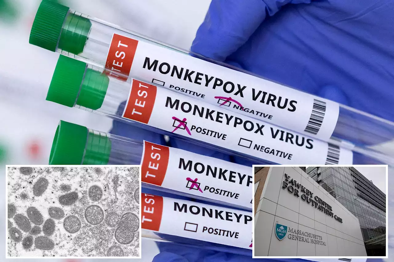 Over 200 people being monitored for monkeypox in Massachusetts