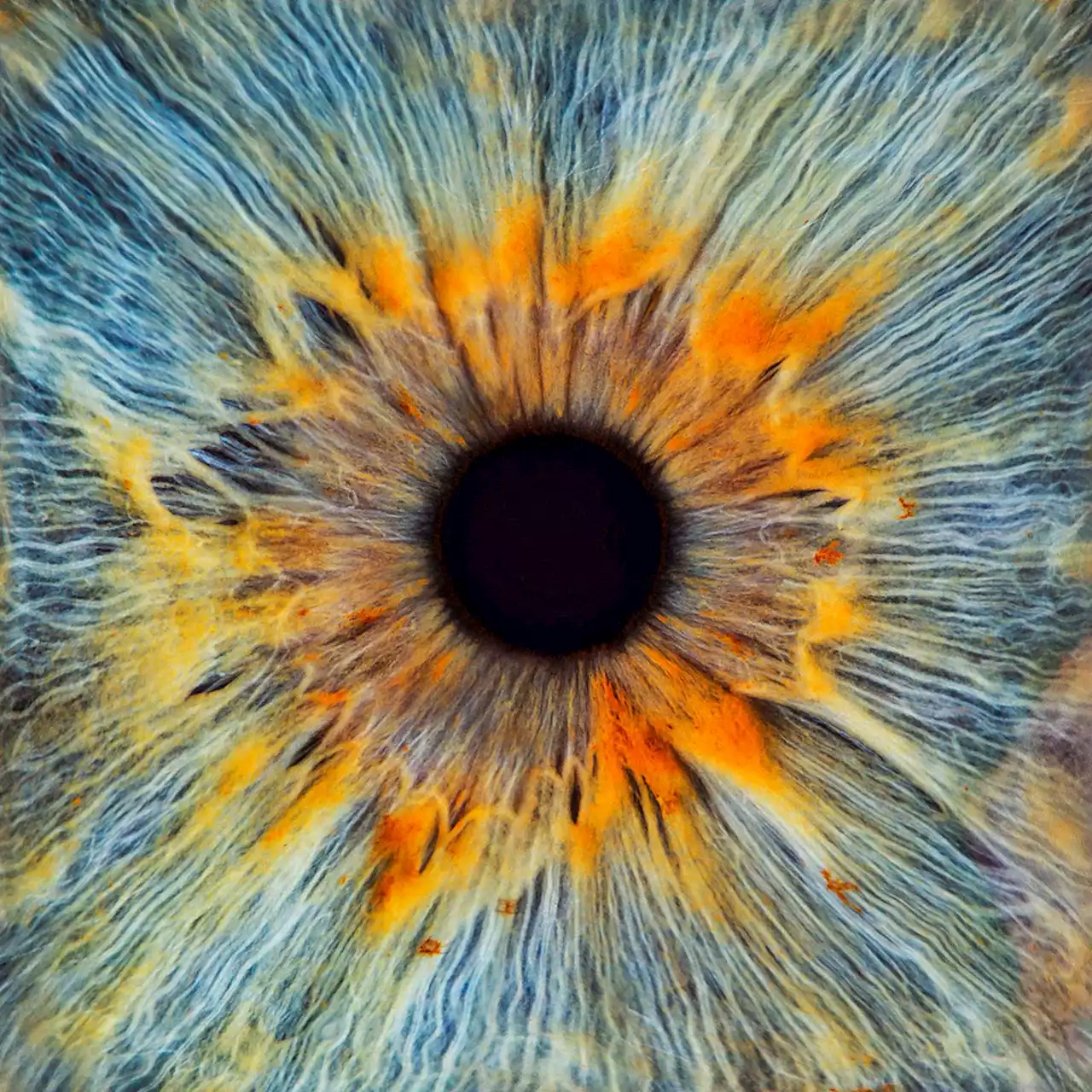 Scientists Have Revived a Glimmer of Activity in Human Eyes After Death