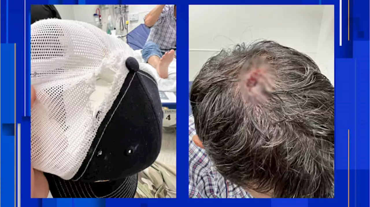 Images show injury of Border Patrol agent who exchanged gunfire with Uvalde school shooter