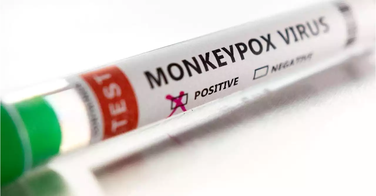 First case of monkeypox confirmed in Ireland