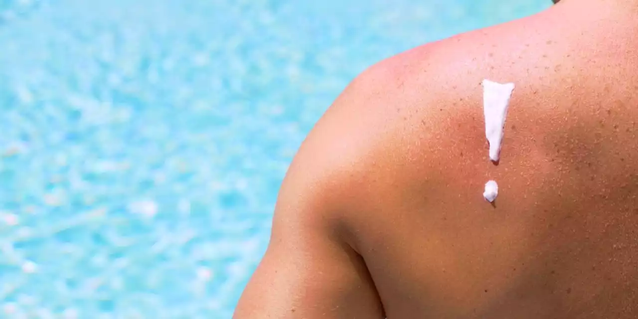 Dangerous Tanning Is on the Rise, Suntan Myths Persist